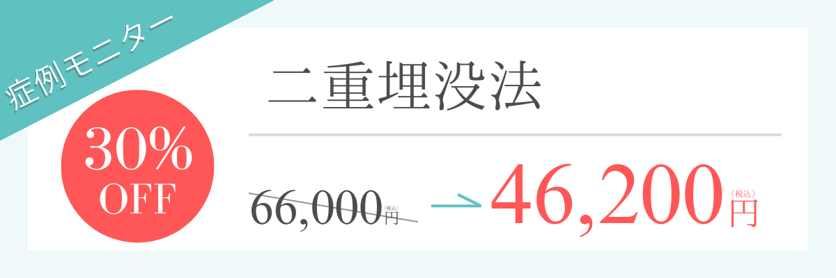 bury-monitor-price-banner