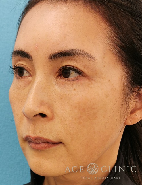 ウルセラ・サーマクール