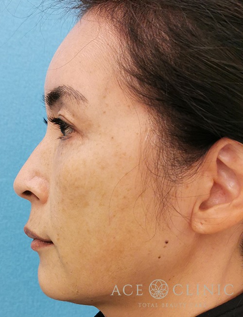 ウルセラ・サーマクール