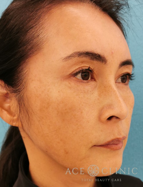 ウルセラ・サーマクール