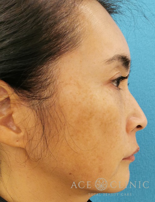 ウルセラ・サーマクール