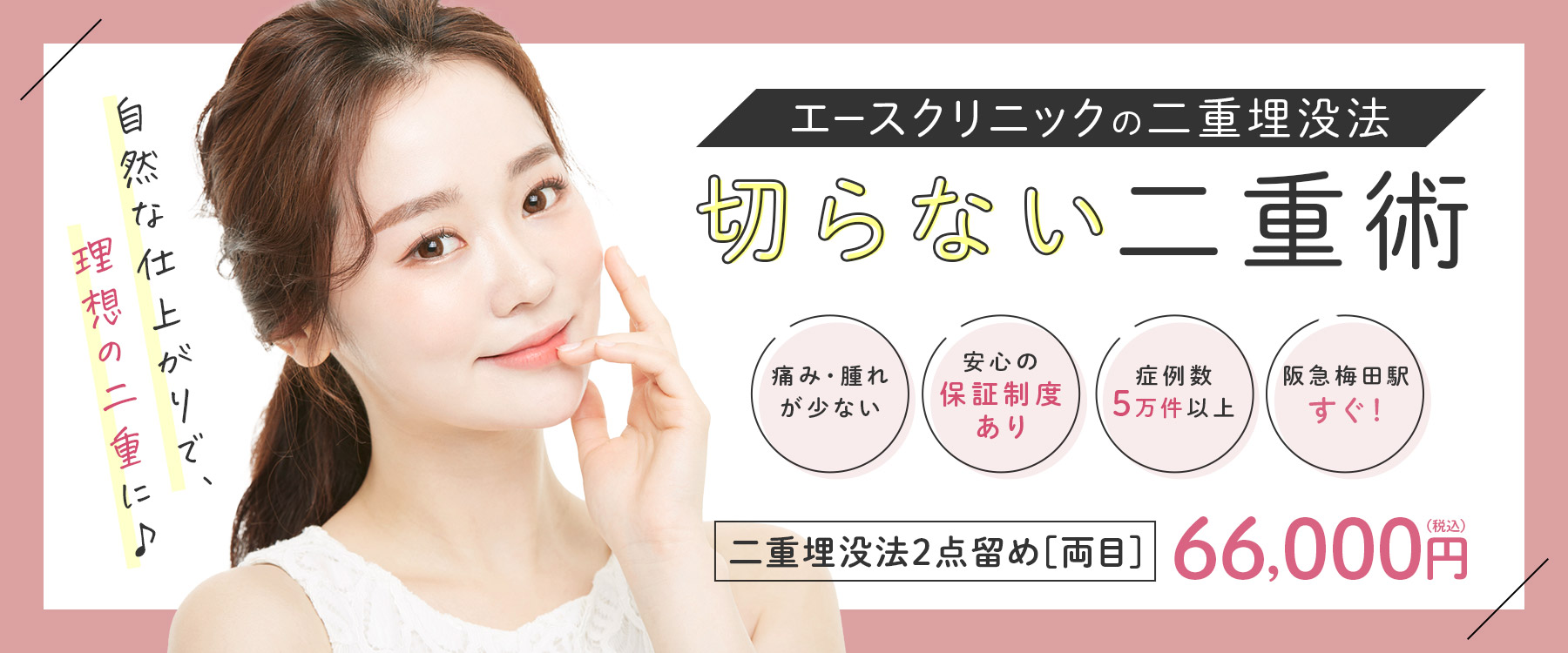エースクリニック二重埋没　切らない二重術