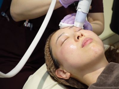 ボルニューマー照射風景