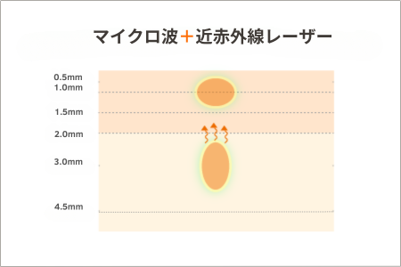 マイクロ波+近赤外線レーザーの熱の入り方のイメージ