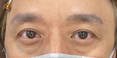 アートメイク3D眉|症例45|男性|術後|大阪梅田HEPナビオ院