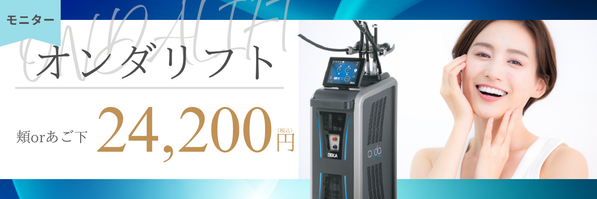 オンダリフト料金バナー