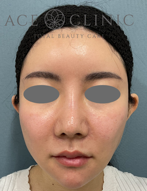 アドバテックス-中山医師