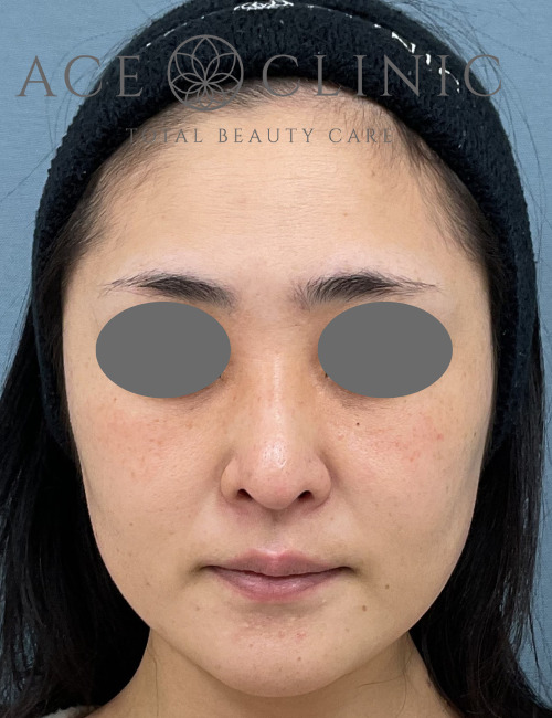 アドバテックス-宇根医師