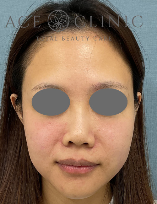 アドバテックス-宇根医師