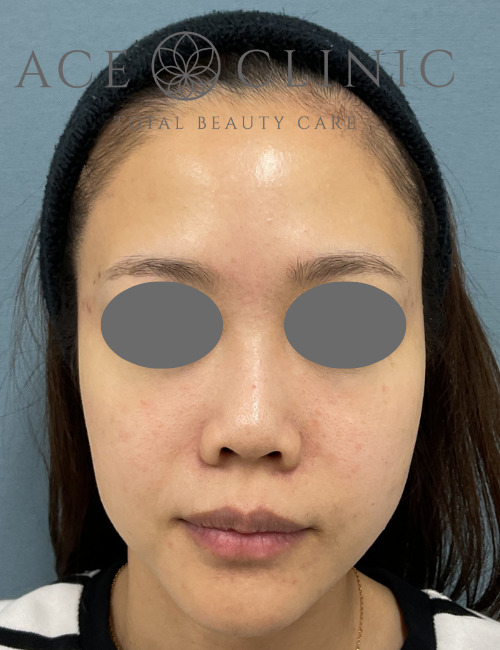 アドバテックス-宇根医師