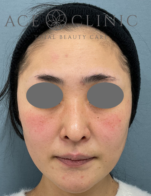 アドバテックス-宇根医師