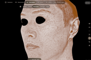 comprehensive-skin-analysis-2