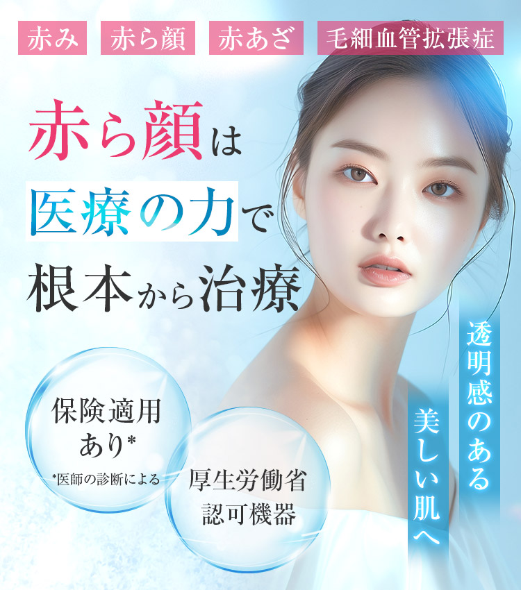 エースクリニック大阪梅田HEPナビオ院 赤ら顔は医療の力で根本から治療