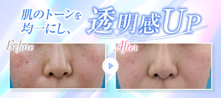 エースクリニック大阪梅田HEPナビオ院は、全国TOP10ランキング入り