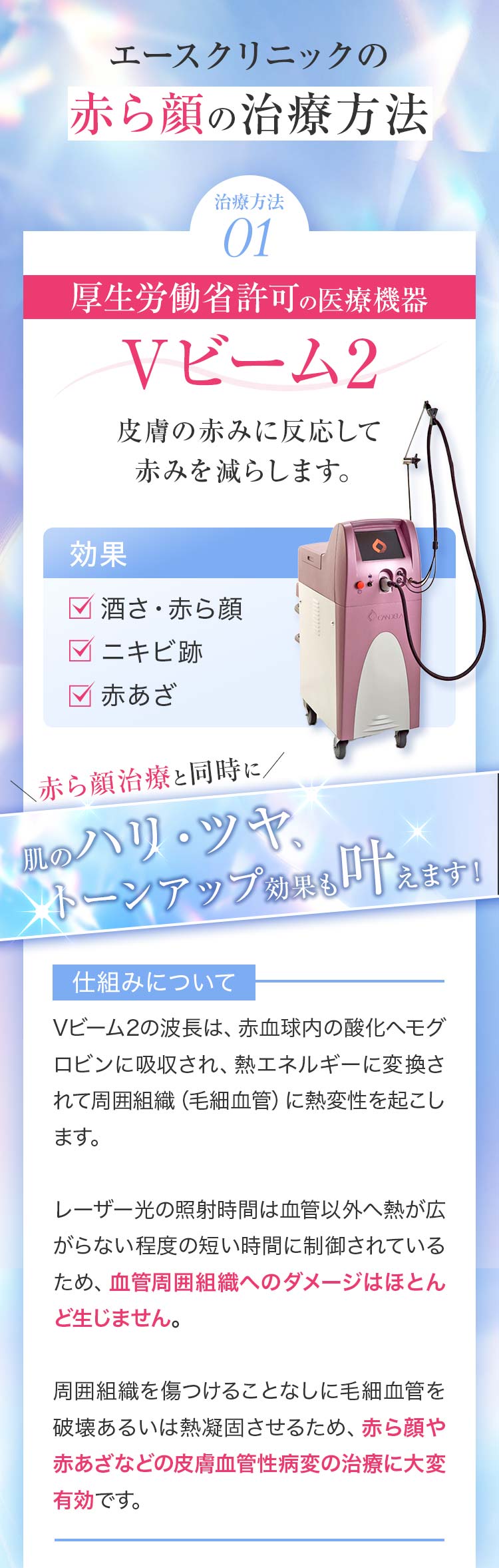 赤ら顔治療の方法　Vビーム2