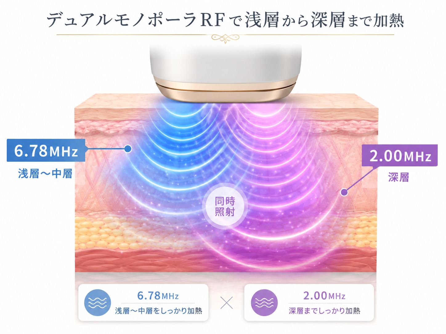 デュアルモノポーラRFで浅い層から深い層まで立体的に加熱