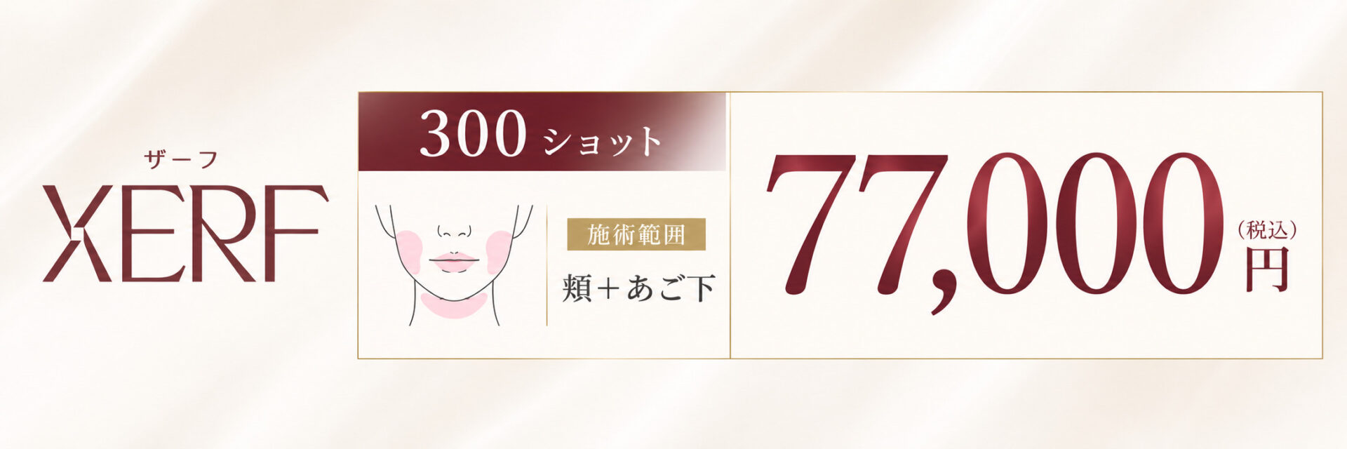 ザーフ料金バナー
