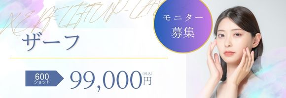 ザーフおすすめプラン