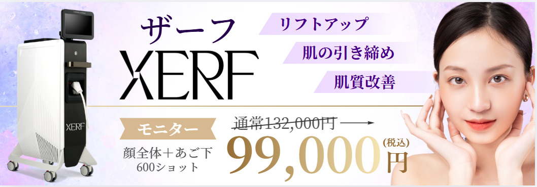 ザーフおすすめバナー