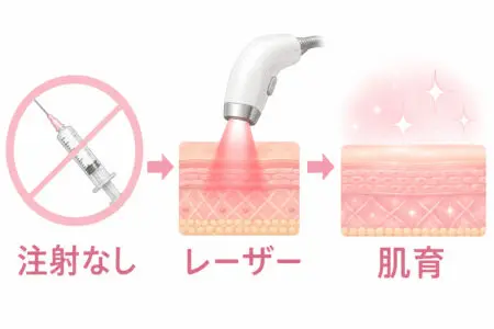 注射を使わない肌育治療